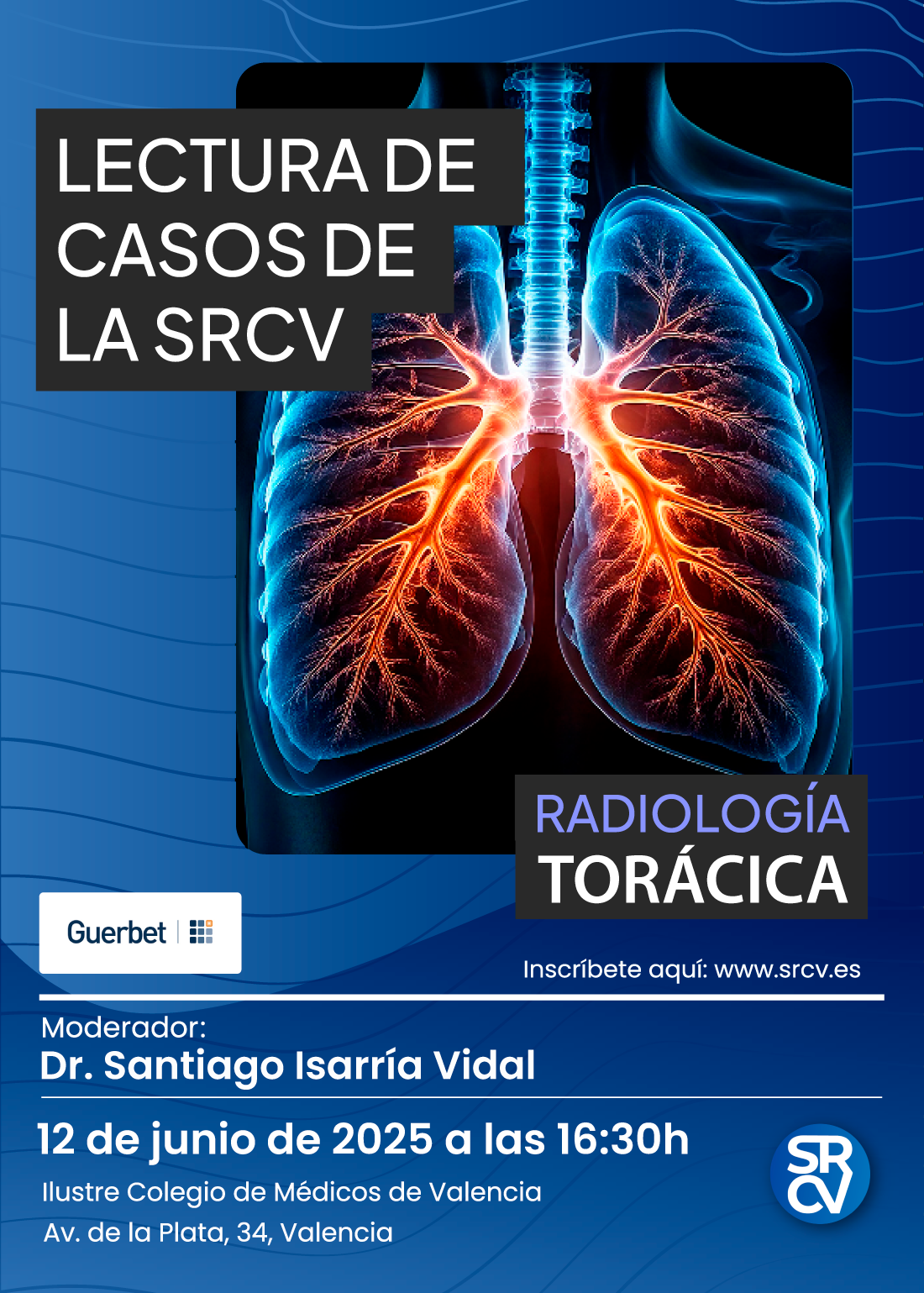LECTURA DE CASOS- RADIOLOGÍA TORÁCICA DE LA SRCV