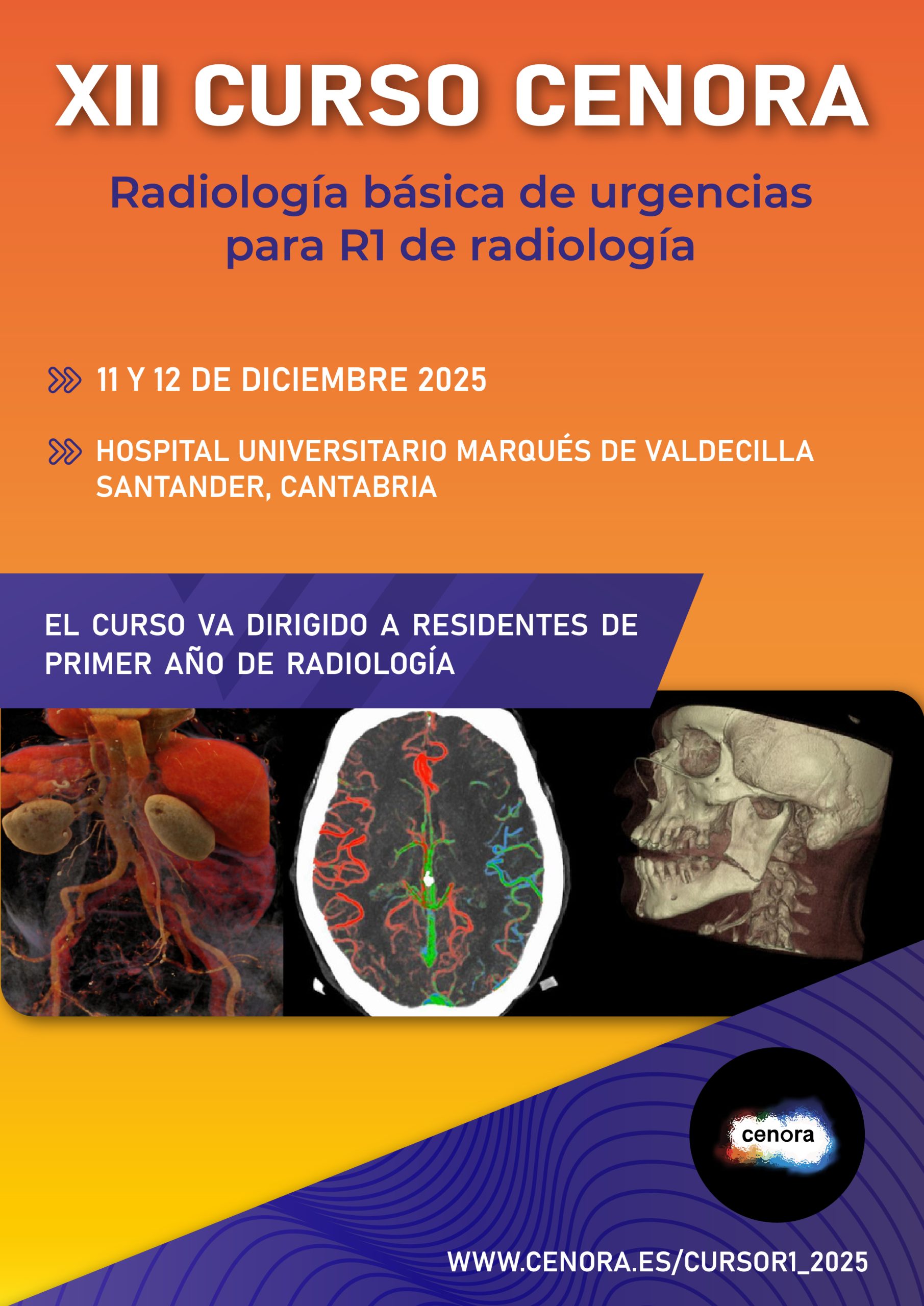 XII Curso R1 CENORA 2025